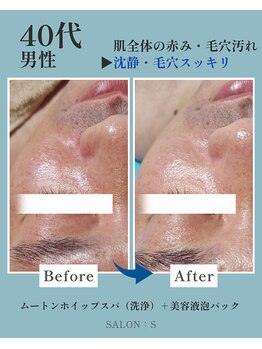 サロンエス(SALON:S)/40代、男性にもおすすめ