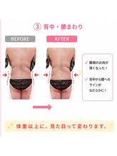 ヨサパーク アンジュ 千早店(YOSA PARK Ange)/