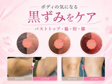 プライベートエステサロン トゥインクルの雰囲気（【黒ずみ改善】LED1回×ホームケアで美白・本来のピンクへ）