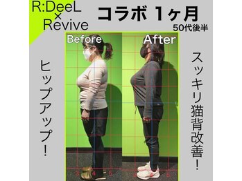 デール(R:DeeL)/痩身マシン×骨格トレーニング