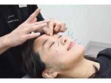 コガオ レンネ(Lenne)/お気軽にご相談ください♪