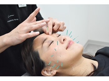 コガオ レンネ(Lenne)/お気軽にご相談ください♪