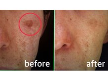 ファイブエレガンテ(5Elegante)/