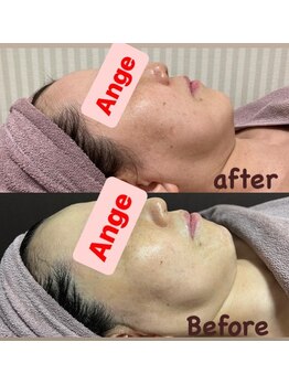 エステルーム アンジュ(Esthe Room Ange)/オールハンドで悩みにアプローチ