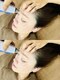 モカラ(MOKARA)の写真/【最先端美容】毛穴の黒ずみやニキビケアなど繰り返す肌トラブルに徹底アプローチ!たるみ改善/ハリ感もUP◎