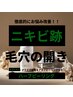 【韓国発】ハーブピールplus（アクアピーリング&プラズマset）徹底ニキビケア