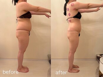 クロレ 浦和店(CLORE)/30代のお客様/7回施術