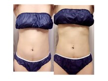 ヨサパーク ヴィオラ(YOSAPARK viola)の雰囲気（luluonで根本痩身！医薬部外品ハーブと水素ミストでデトックス♪）