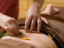 お身体の状態に合わせて必要な施術を行います。