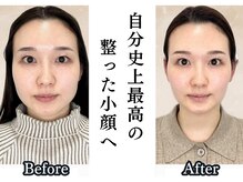 ザ リフト カドモリ 鹿児島 霧島(The Lift KADOMORI)