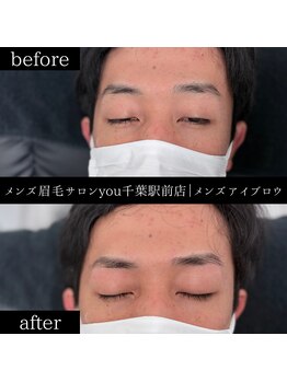 ユー 千葉駅前店(you)/ビフォ－アフター写真