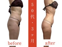 ウィズルーチェ 神栖店(with luce)/痩身効果★ダイエットに終止符を