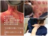 深層※電気カッサ+吸玉しながら (箇所消炎鎮痛剤使用)全身強揉み 90分