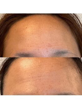 チェリッシュ フェイス 藤沢(CHERISH FACE)/イーライト光