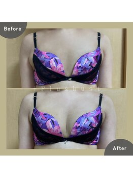 プラス バスト(+Plusバスト)/お客様BeforeAfterお写真