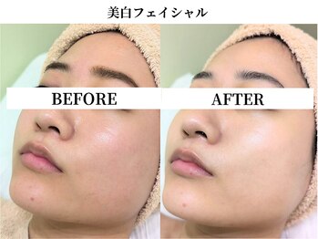 サンビ(SANBI)/くすみ除去でトーンアップ！