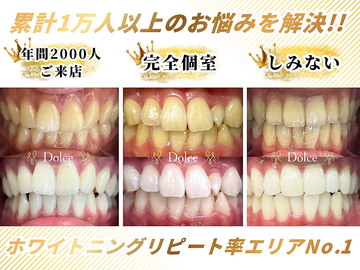 ドルチェ(Dolce)｜ホットペッパービューティー