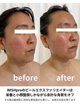 ブルーム(BLOOM)/敏感肌にも安心/ウイッシュプロ