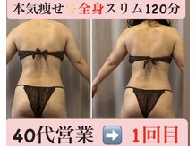 マール(Mar)/1回の結果出し！痩身/全身スリム