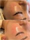 ミラビューティー(Mira Beauty)の写真/くすみ・シミをケアして透明感あふれる明るい印象のお肌へ