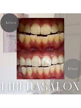 リベラサロン(LIBERA SALON)/本来の白さを取り戻します◎