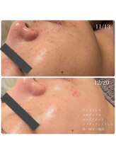 エクラ(eclat)/クリスティーナ