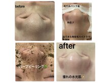 リラックスアンドビューティ(Relax&Beauty)の雰囲気（最新型毛穴洗浄マシン導入！毛穴洗浄が得意＆自慢のサロンです★）