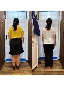 ヒデ整体院(Hide整体院)/40代女性１５９cm痩身脂肪肝改善