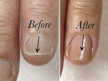 トゥインクリーネイルサロン(Twinkly Nail Salon)/【最強のネイルケア】1回お試し