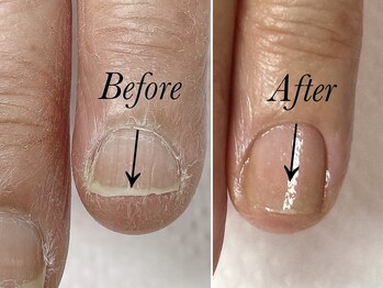 トゥインクリーネイルサロン(Twinkly Nail Salon)/【最強のネイルケア】1回お試し
