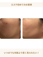 シェリーク 東京店/年齢より若く見られたい！