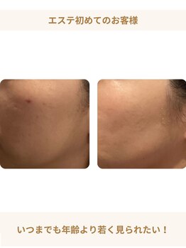 シェリーク 東京店/年齢より若く見られたい！