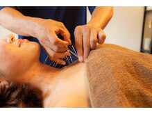 はりひろし鍼灸院/頑固なコリを根本改善★