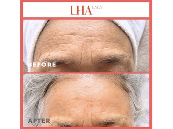 ベルフィオーレ(bel fiore)/ララピール