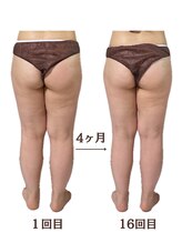 ラニカイ 八代店(Lanikai)/痩身エステ　20代のお客様