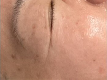 エコム(ECOM)の写真/【本格シミケア機器◆OTHELLO◆エリア新導入!!】完全個室のラグジュアリー空間でゆったりお受け頂けます♪