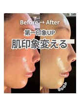 エステ ココ 土気店(Esthe CoCo)/#ハーブピーリング#リンパ#赤み