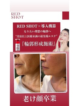 リンダ(Rinda)/【3月】韓国美容でたるみ改善★