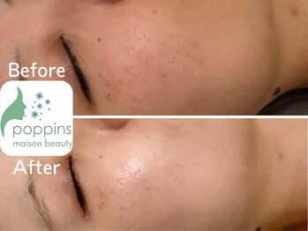 メゾンビューティーポピンズ 恵比寿(maisonbeauty poppins)/クリスティーナ　イラストリアス