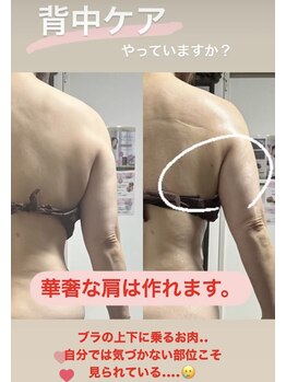 アローナ(ARONA)/本格的オーダーメイド痩身