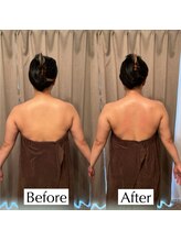 アイミーボーテ(Aime beaute)/《上半身DETOX》