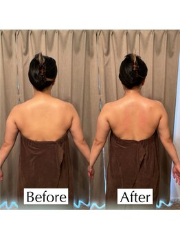 アイミーボーテ(Aime beaute)/《上半身DETOX》