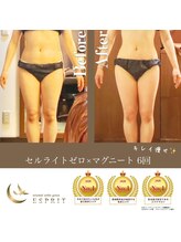 エスプリ 新宿店/痩身エステ新宿・くびれ新宿