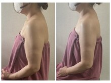 ブリランテ(Brillante)/