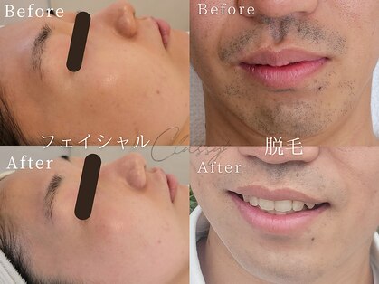 クラッシー 本八幡(CLASSY+)の写真