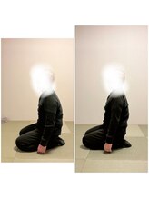 ツリー鍼灸整骨院 吹田店(TREE鍼灸整骨院)/腕の痛みを整体で改善