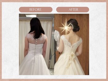 ソウイボディ 武蔵小杉店(Sou-i body)/ブライダルbefore→ after