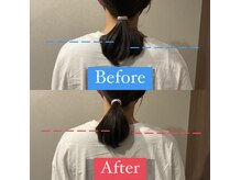 ナオル整体 宮崎院(NAORU整体)/20代女性施術事例【姿勢改善】