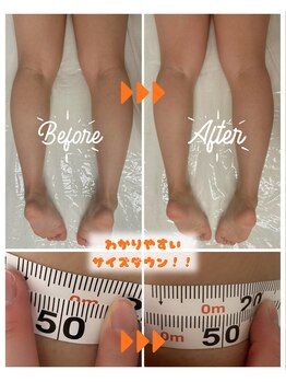 スリモア(SLIMORE)/ビフォーアフター☆足