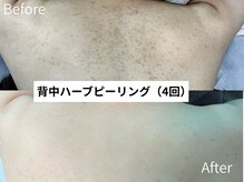 アンドナイン エス店(ANDNINE.)の雰囲気（長年の肌悩み…本気の肌質改善を求める方へ！ハーブピーリング）